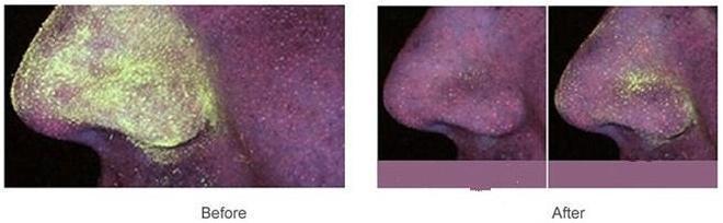 Electric Facial Cleansing Brush