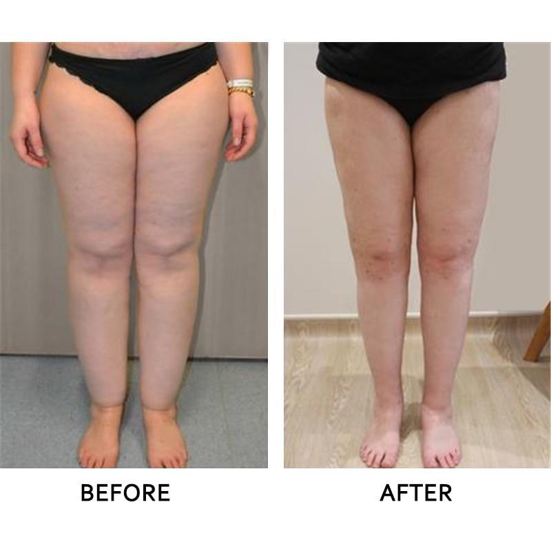 Anti-Swelling Ginger Foot Detox Patch (10 pcs)